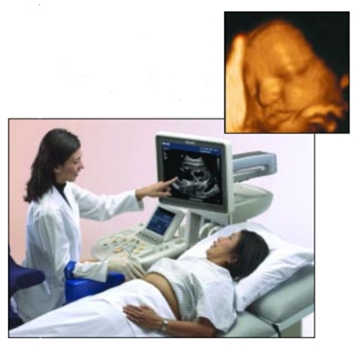 GALIL應(yīng)用案例&mdash;&mdash;Galil控制器有助于提供清晰度令人驚喜的子宮內(nèi)3D影像